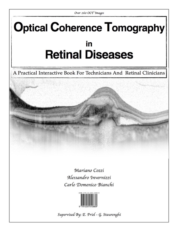 Optical Coherence Tomography in Retinal Diseases