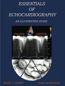 Essentials Of Echocardiography: An Illustrative Guide