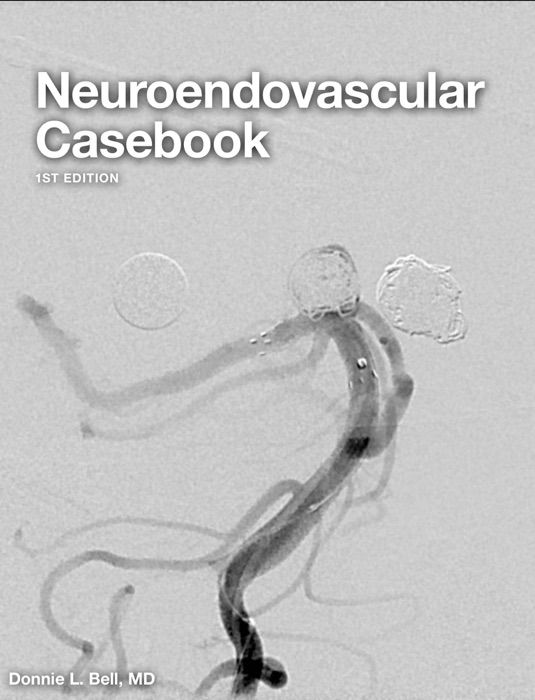 Neuroendovascular Casebook