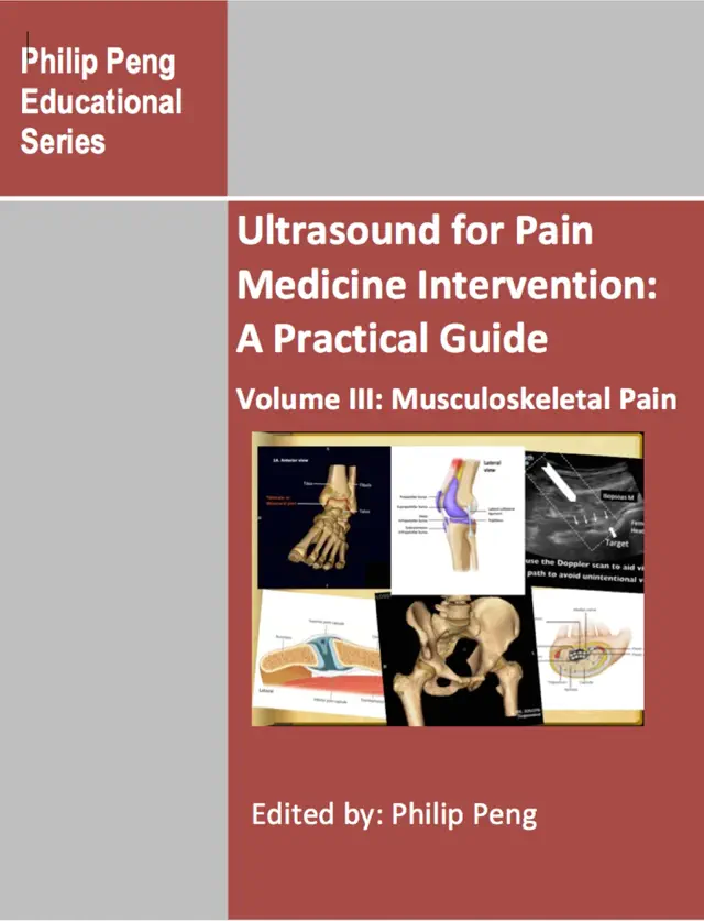 Ultrasound for Pain Medicine Intervention: A Practical Guide