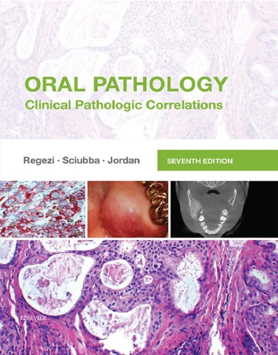 Oral Pathology - E-Book