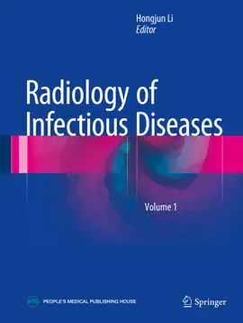 Read: Radiology of Book Infectious Diseases: Volume 1