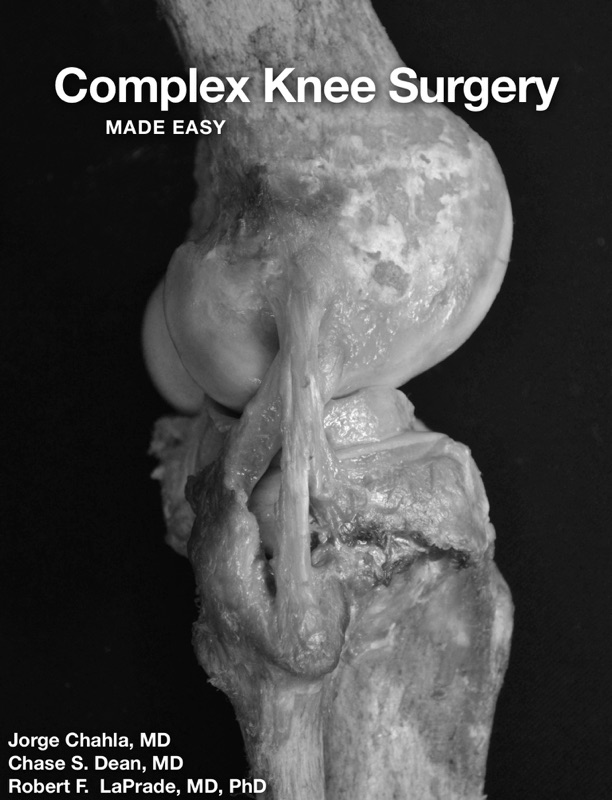 Complex Knee Surgery