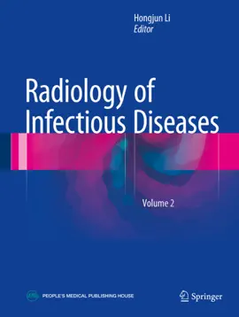 Read: Radiology of Infectious Diseases: Volume Book 2