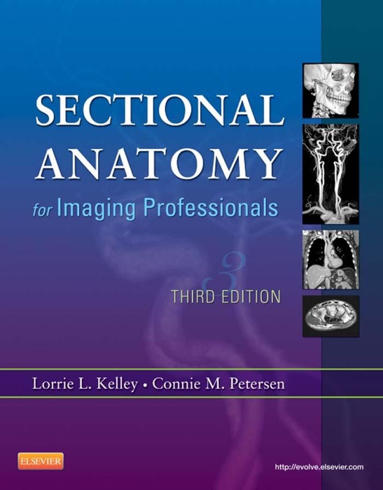 Sectional Anatomy for Imaging Professionals