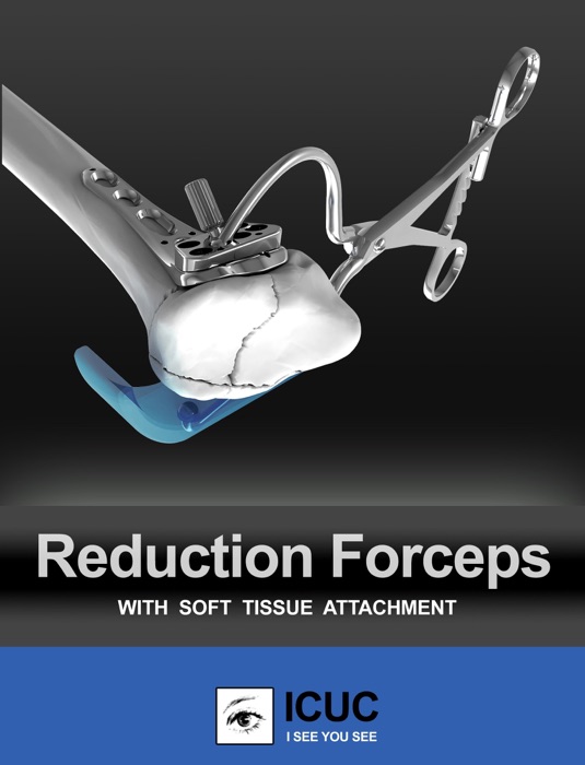 Reduction Forceps