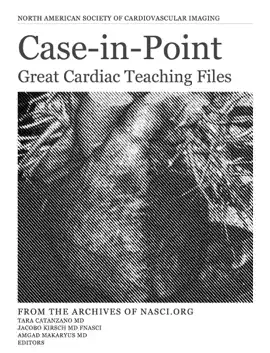 Case-in-Point