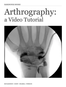 Read: Arthrography: A Video Tutorial (Enhanced Book Version)