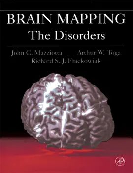 Read: Brain Mapping: Book The Disorders