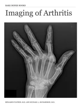 Read: Book Imaging of Arthritis
