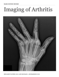 Imaging of Arthritis