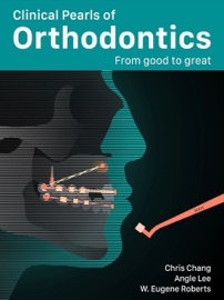 Clinical Pearls of Orthodontics