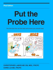 Put the Probe Here