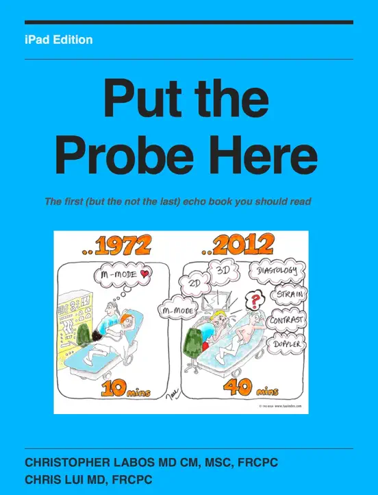 Put the Probe Here