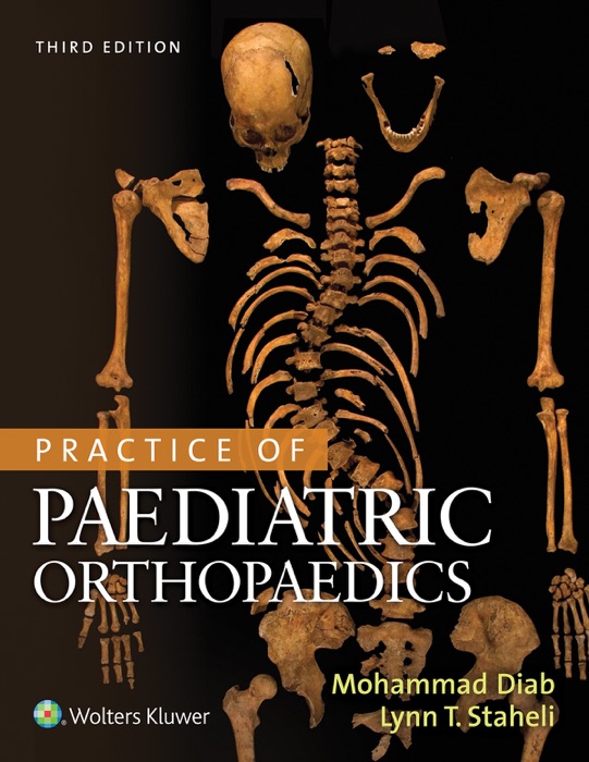 Practice of Paediatric Orthopaedics: Third Edition