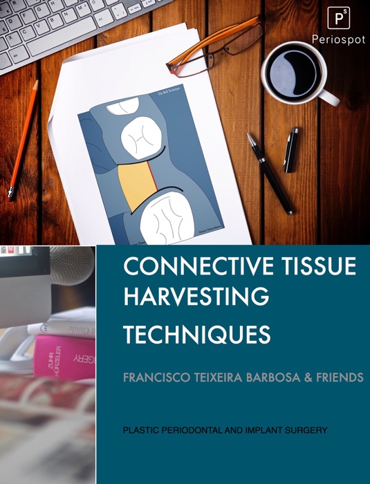 Connective tissue harvesting techniques