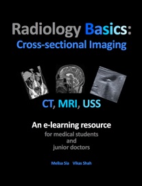 Book Radiology Basics: Cross-sectional Imaging - Melisa Sia & Vikas Shah