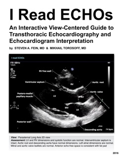 I Read ECHOs by Steven A. Fein & Mikhail Torosoff