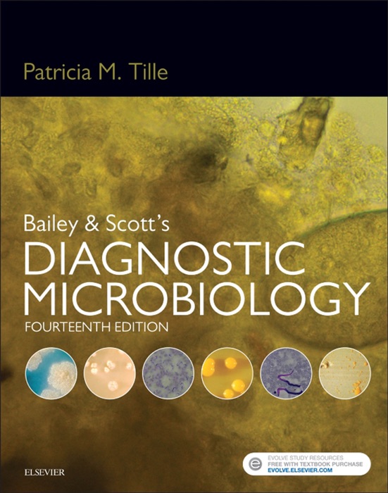 Bailey & Scott's Diagnostic Microbiology - E-Book
