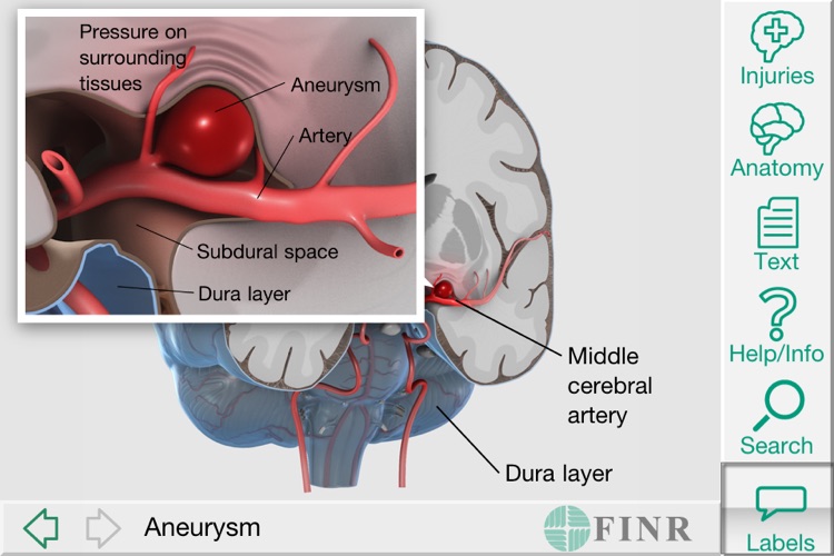 FINR Brain Atlas