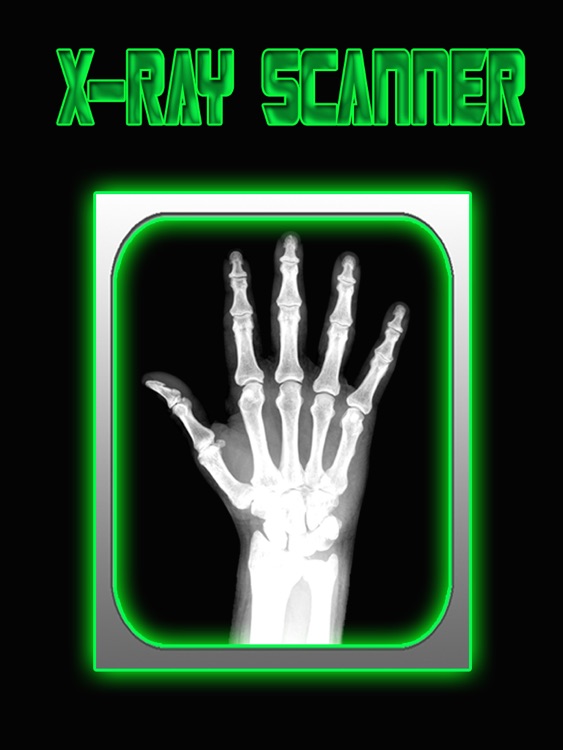 X-Ray Scanner HD for iPad screenshot-3
