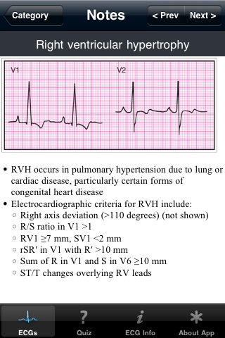 ECG Pocket Reference Free