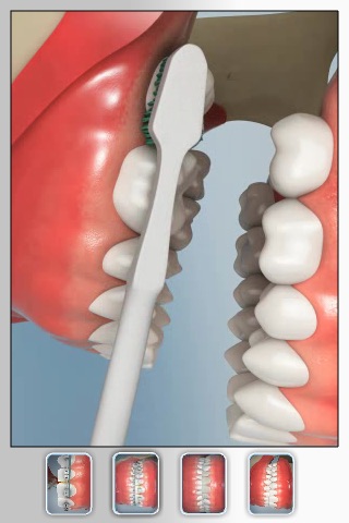 Dr. Boutin Orthodontics: CavityFree 3D