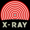 X-Ray Effect