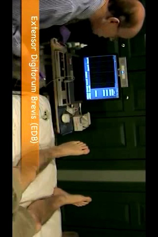 PocketEMG: EMG Needle Exam 1 screenshot 3