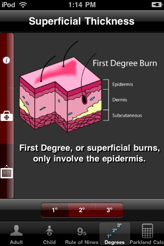 uBurn Lite