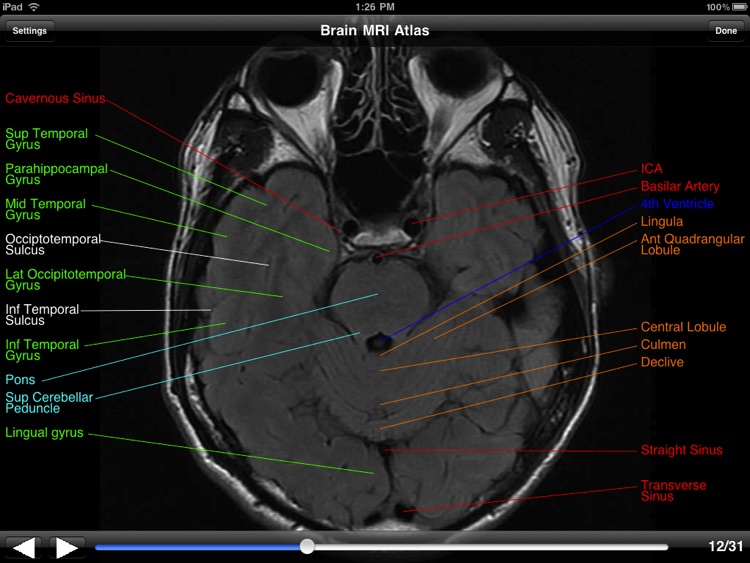 Brain MRI Atlas