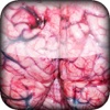 Brain Rot