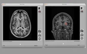 isurf brainview desktop iphone capturas de pantalla 1