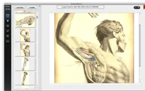 surgical anatomy - premium edition iphone resimleri 4