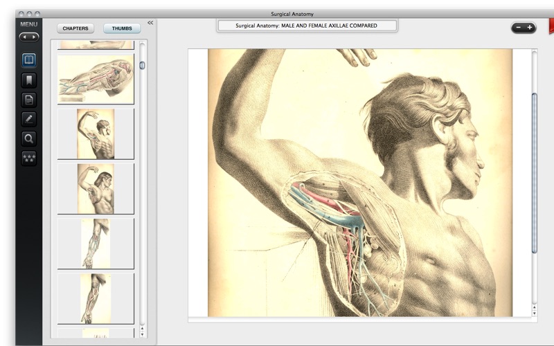 surgical anatomy - premium edition iphone screenshot 4