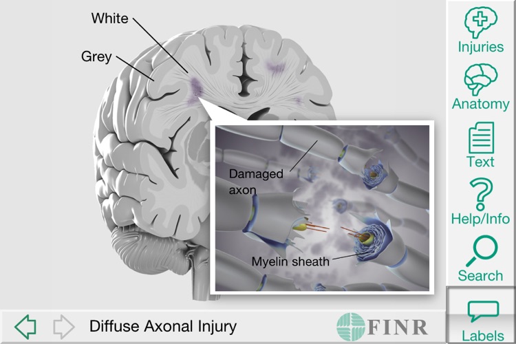 FINR Brain Atlas screenshot-4