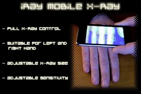 iRay Mobile X-Ray
