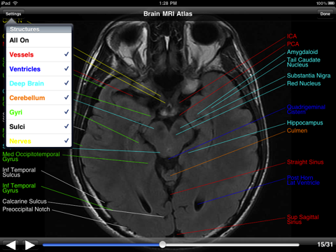 Brain MRI Atlas screenshot 2