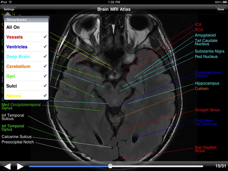 Brain MRI Atlas
