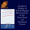 Fetal Heart Doppler