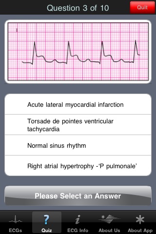ECG Pocket Reference Belgium