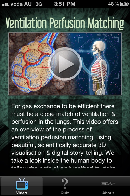 Ventilation Perfusion Matching