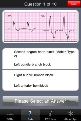 ECG Pocket Reference Free screenshot-3