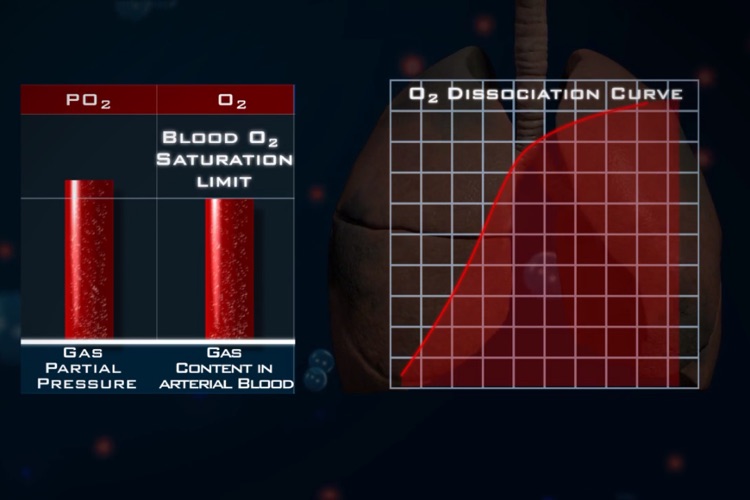 Ventilation Perfusion Matching screenshot-3