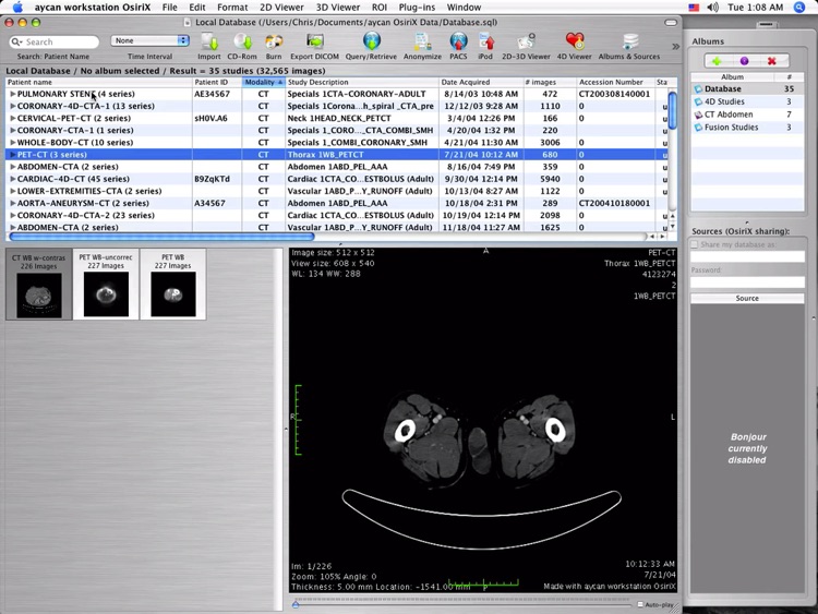 OsiriX PRO Video Tutorials