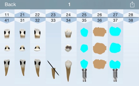 DentalChart Pocket screenshot 3