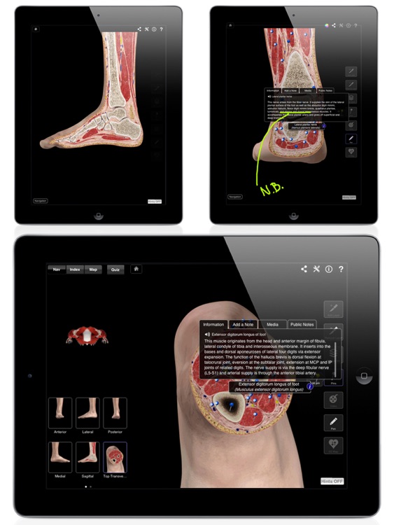 Ankle & Foot Pro III for iPad
