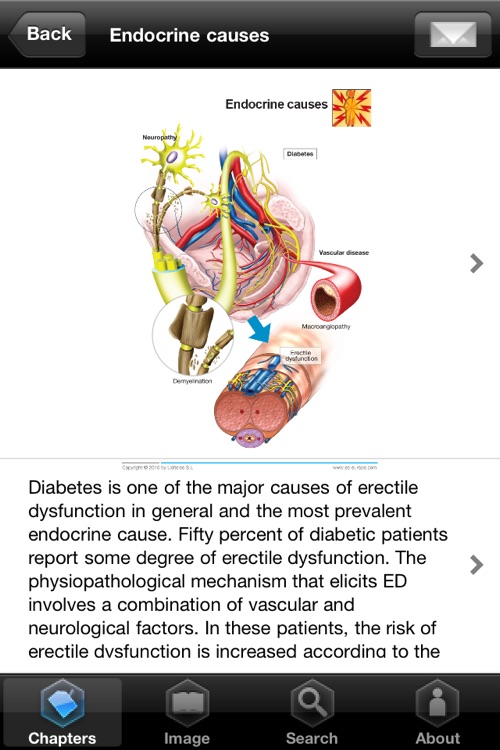 Miniatlas Erectile Dysfunction screenshot-3