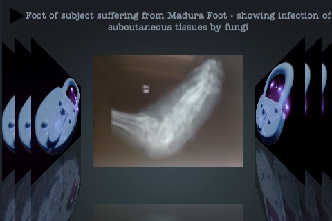 X-rays screenshot-3