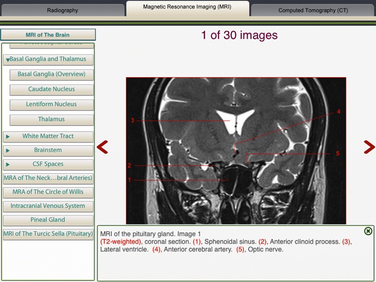 MRI-Xray Human Body screenshot-3